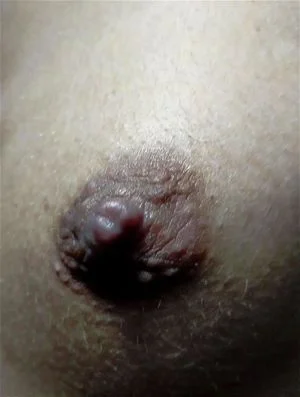 Breast thumbnail