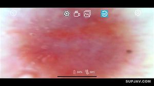Watch from 1:01:59