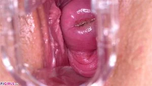 CERVIX thumbnail