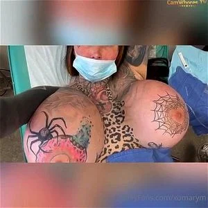 FAKE TITS - BREAST IMPLANTS thumbnail