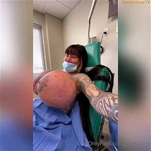 FAKE TITS - BREAST IMPLANTS thumbnail