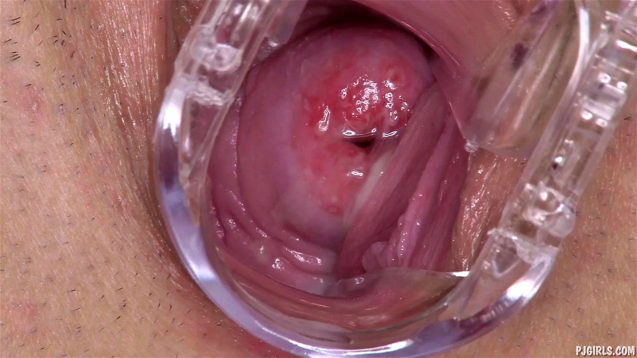 SPECULUM V - PINK CERVIX - LOOK DEEP INSIDE Video Porno - SpankBang