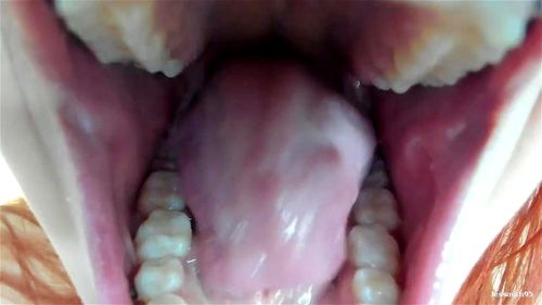 Throat/Uvula thumbnail