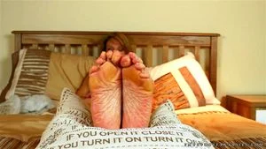 Calloused feet thumbnail