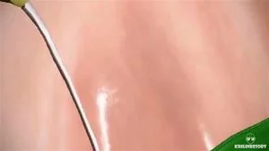 Watch from 0:03:01