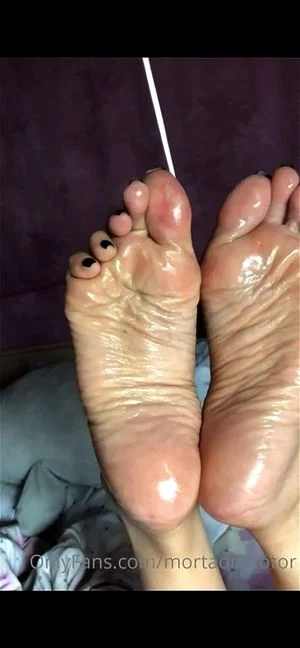 Oily Feet n Soles  thumbnail