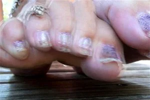 Feet thumbnail