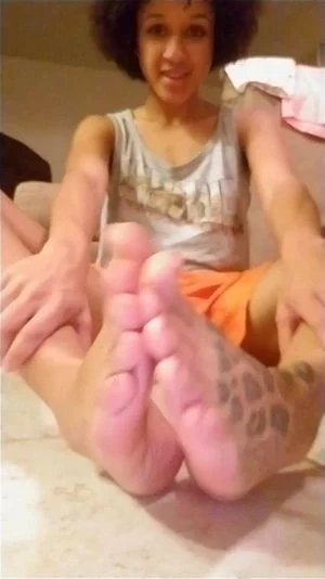 Oily Feet n Soles  thumbnail