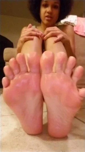 Oily Feet n Soles  thumbnail