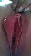Vagina close up Vagina close up
