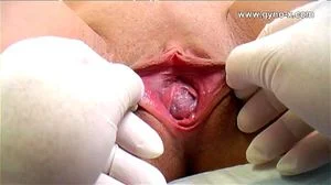 Medical thumbnail