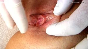 Medical thumbnail