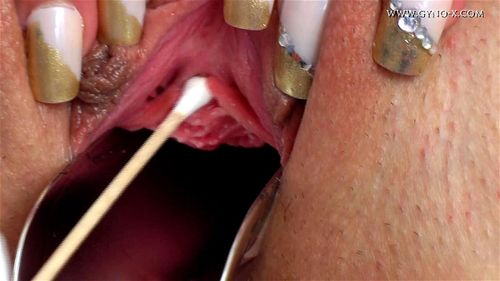 Gyno-x Frida (2011) - Gyno, Gyno-X, Brunette Porn
