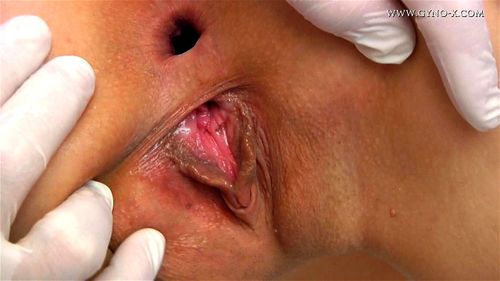Watch Gyno-x Nolita 