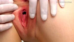 cervix thumbnail