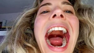 Uvula thumbnail