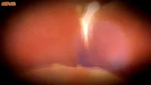 Animated thumbnail