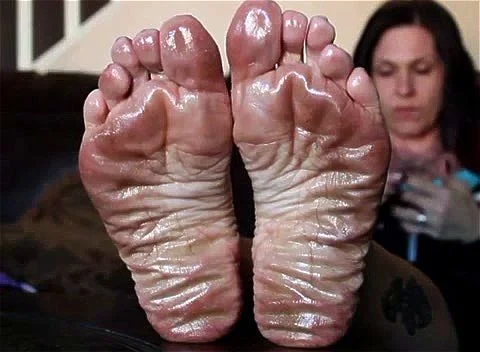Wrinkled Soles Oily