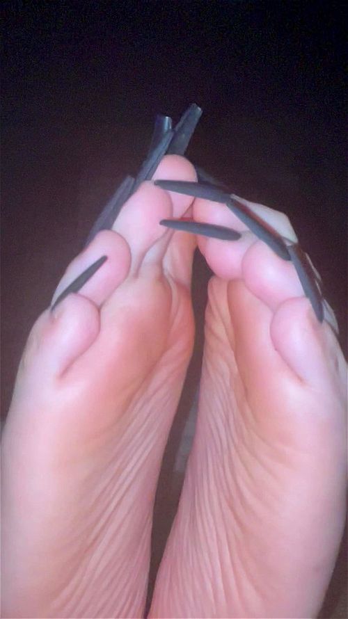 Long black toenails