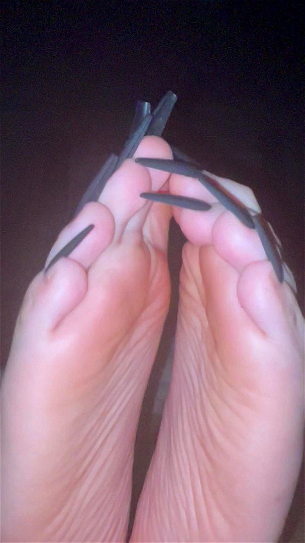 Long black toenails Long black toenails
