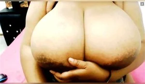 Areolas  thumbnail