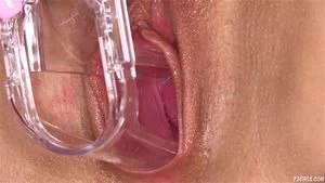 Speculum thumbnail