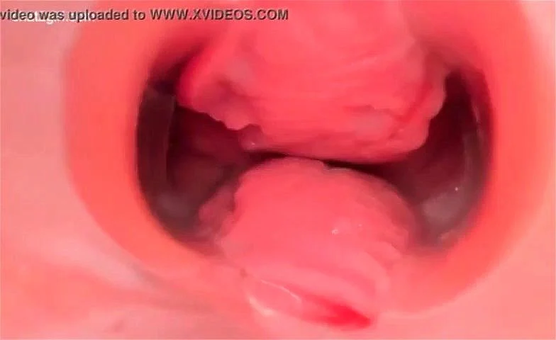 endoscope endoscope