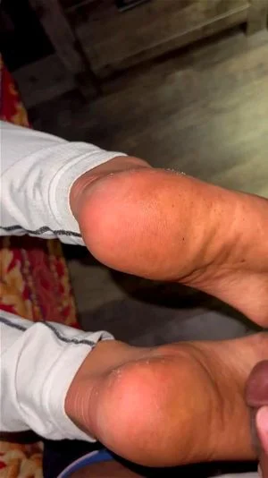 Nut on soles thumbnail