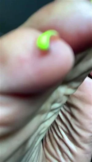 Toes thumbnail