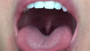 Throat view thumbnail