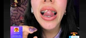 Uvula thumbnail