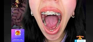 Uvula thumbnail