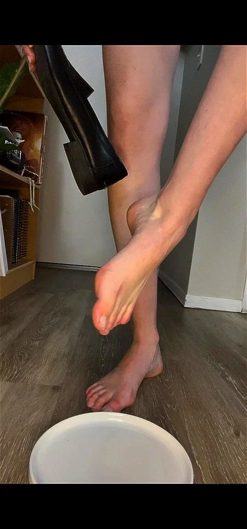 High arches and toe jam High arches and toe jam