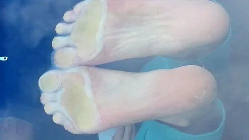 Sweaty feet thumbnail