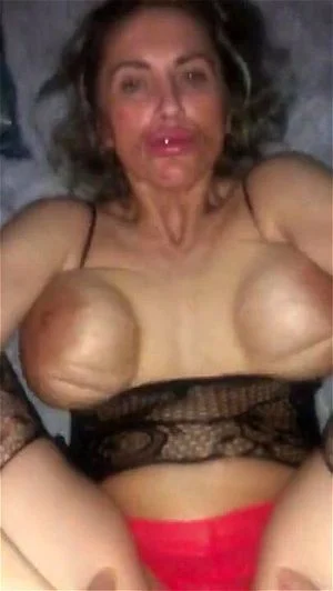 Nasty thumbnail