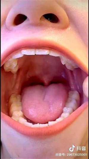 chinese mouth