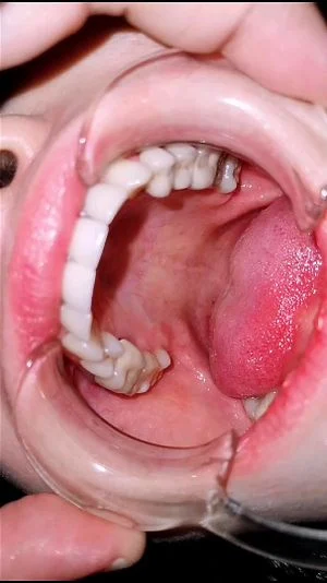 Mouth thumbnail