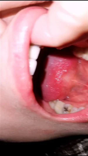 Mouth thumbnail