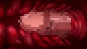 Hentai（Erotic Scenes） thumbnail