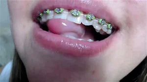 Mouth thumbnail