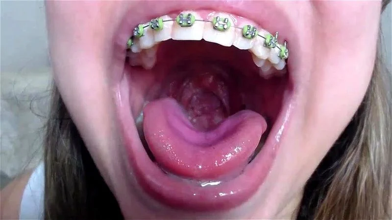 Hot Mouth Braces Blond BBW Tongue Spit Fetish