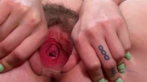 hairy thumbnail