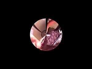 Watch from 0:07:20