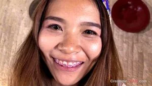 Latina Braces thumbnail