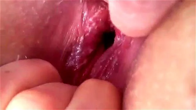 huge anal