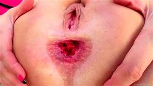 bald thumbnail
