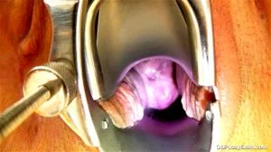 gyno exam thumbnail