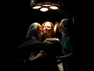 Lesbian Clitoral Stimulation Surgery