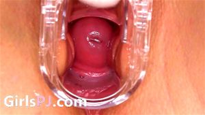 Vaginal Speculums thumbnail