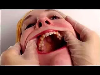 teeth inspection